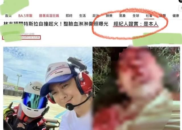 车祸细节曝光：林志颖满脸是血，6岁儿子疑似坐副驾，不到5秒爆炸