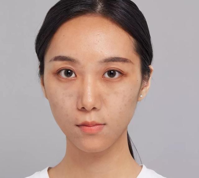 皮肤状态变差，脸上色斑遍布，常做3件事，或有助斑点淡化