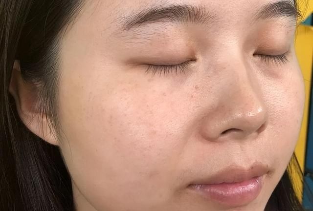皮肤状态变差，脸上色斑遍布，常做3件事，或有助斑点淡化