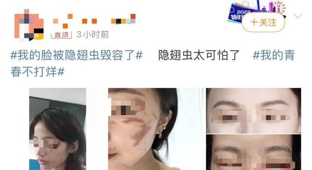 千万别用手拍！它是“飞行的硫酸”，其毒液险至人毁容、失明……